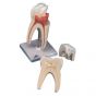 Dente molare superiore a tre radici, in 3 parti D10/5