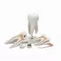Dente molare superiore a tre radici, in 6 parti D15