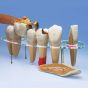 Set di Protesi dentaria Ingrandita W42529