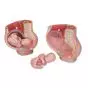 MEDart™ Bacino in gravidanza MAL20