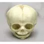 Cranio di feto alla 30ma settimana di gravidanza Erler Zimmer 4757