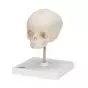 Cranio di feto, su cavalletto A26