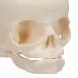 Cranio di feto A25