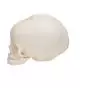 Cranio di feto A25