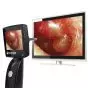 Otoscopio video LCD HD 2,4'' Spengler OtoScreen