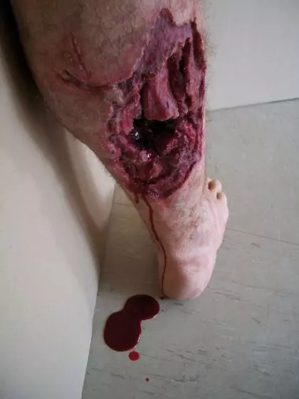 Modello di gamba con ferita di guerra Erler Zimmer R50010