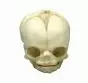 Modello di cranio feto di 21 settimane e ½ 4762 Erler Zimmer