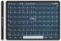  Elettrocardiografo ECG Cardiomate EVI (12 derivazioni) con interpretazione Spengler