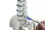 Modello di colonna vertebrale con ernia del disco, bacino e tronchi dei femori 4033 Erler Zimmer