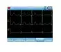 Elettrocardiografo ECG portatile a 3 canali Contec 90A con interpretazione