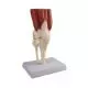 Articolazione del ginocchio umano a grandezza naturale con muscoli Erler Zimmer 4662