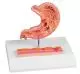 Modello dello stomaco umano con ulcere gastriche Erler Zimmer K217