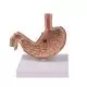 Modello anatomico di stomaco con ulcera K80 Erler Zimmer