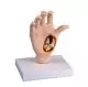 Modello anatomico della mano con artrosi M25 Erler Zimmer