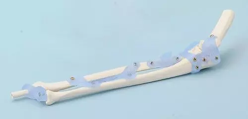 Modello di articolazione del gomito con legamenti  4557 Erler Zimmer