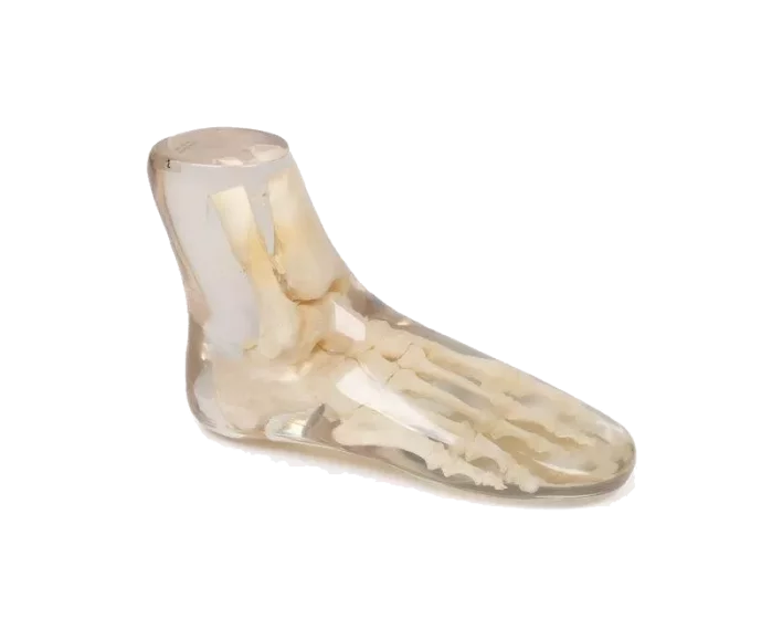 Fantasma radiografico del piede Erler Zimmer