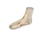 Fantasma radiografico del piede Erler Zimmer