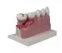 Modello anatomico di denti ingrandito 4 volte D250 Erler Zimmer