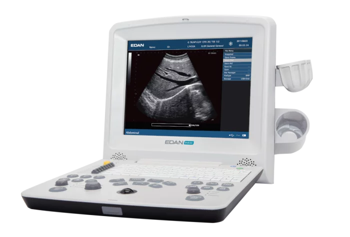 Ecografo portatile Edan DUS60