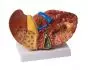 Modello anatomico del fegato con malattie K75 Erler Zimmer