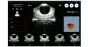 Scanner vescicale / Scanner vescicale portatile Peaksonic BladderView M4