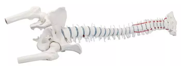 Modello di colonna vertebrale con ernia del disco, bacino e tronchi dei femori 4033 Erler Zimmer