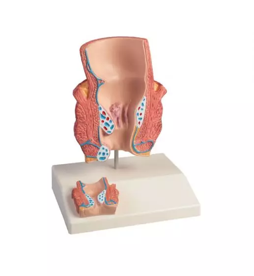 Modello delle emorroidi ingrandito 2 volte Erler Zimmer K227