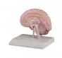 Sezione destra del cervello umano Erler Zimmer C215