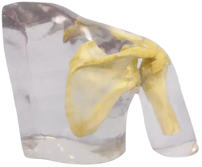 Fantasma radiografico della spalla Erler Zimmer