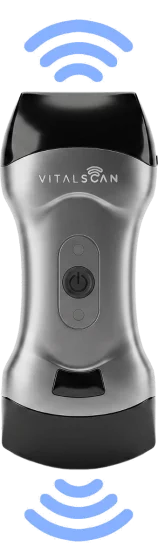 Ecografo connesso ultraportatile Vital Scan X5