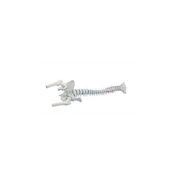 Colonna vertebrale standard con prolasso discale, testa del femore e bacino Erler Zimmer 4033-1