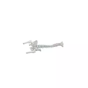 Colonna vertebrale standard con prolasso discale, testa del femore e bacino Erler Zimmer 4033-1