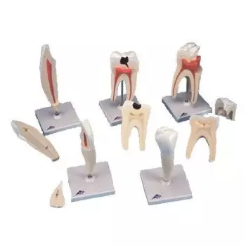 Serie di denti, 5 modelli D10