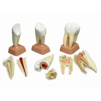 Dente molare superiore con tre radici, in 2 parti VE298