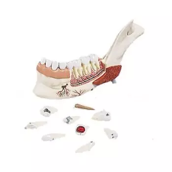 Modello di Metà mandibola con 8 denti cariati, in 19 parti VE290