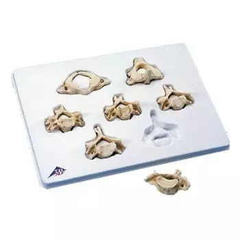 Set BONElike con 7 vertebre cervicali A790