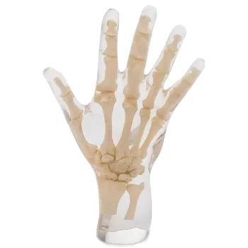 Fantasma radiografico della mano Erler Zimmer