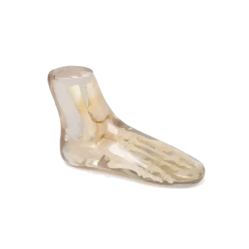 Fantasma radiografico del piede Erler Zimmer
