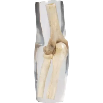 Fantasma del gomito a raggi X di Erler Zimmer