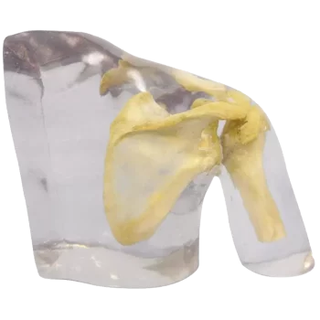 Fantasma radiografico della spalla Erler Zimmer