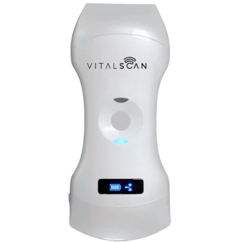 Ecografo connesso ultraportatile Vital Scan X5