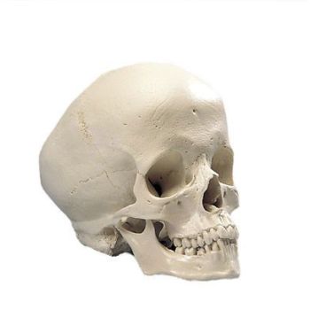 Cranio idrocefalo A29/2