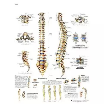 Tavola anatomica La colonna vertebrale, Anatomia e patologie VR2152UU 3B Scientific