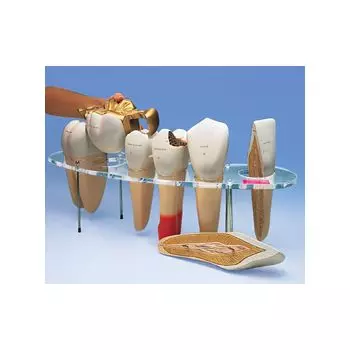 Modello di protesi dentaria, ingrandito 10 volte, in 7 parti - Tedesco W42528