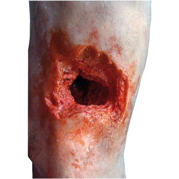 Modello di gamba con ferita da granata Erler Zimmer R50020