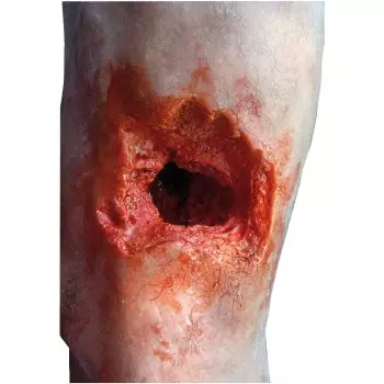 Modello di gamba con ferita da granata Erler Zimmer R50020