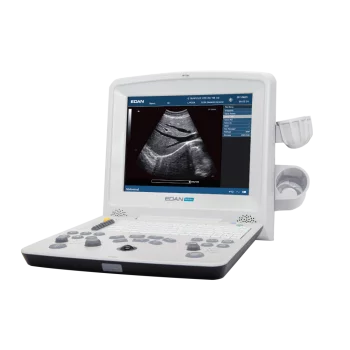 Ecografo portatile Edan DUS60