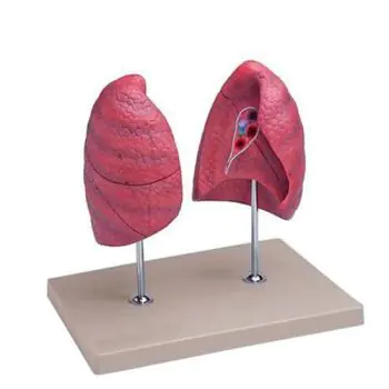 Modello anatomico dei polmoni ingrandito 1,5 volte