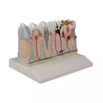 Modello anatomico di denti ingrandito 4 volte D250 Erler Zimmer