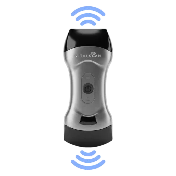 Ecografo connesso ultraportatile Vital Scan X5